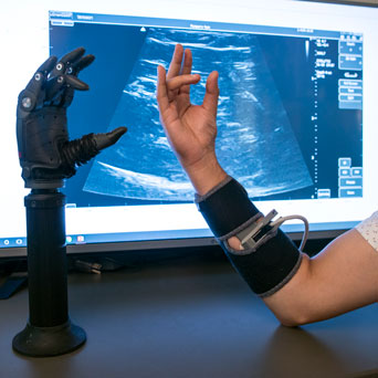 mechanical arm mimics movement by researcher's arm