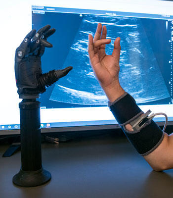 Prosthetic arm and hand controlled by device attached to tester's arm and hand